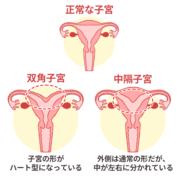 子宮と卵巣